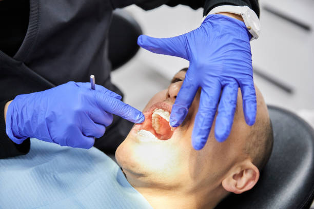 Best Chipped Tooth Repair Near Me  in Graham, WA